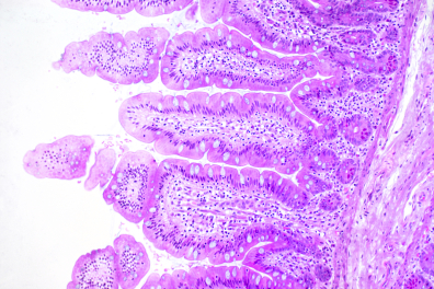Intestin grêle - muqueuse intestinale x25